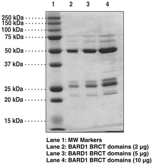 BARD1 BRCT domains (human, recombinant)