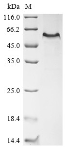 EGF-containing fibulin-like extracellular matrix protein 1 (Efemp1), mouse, recombinant
