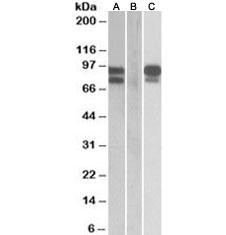 Anti-PCSK9