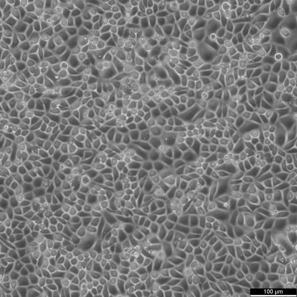 RWPE-1 Cells