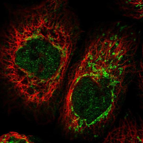 Anti-CIAPIN1