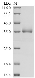 Vesicular integral-membrane protein VIP36 (LMAN2), partial, human, recombinant