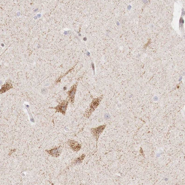 Anti-CLCN5