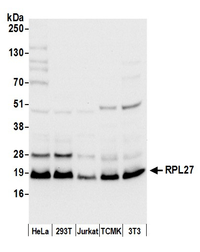 Anti-RPL27/Ribosomal Protein L27