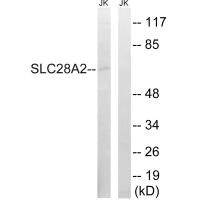 Anti-SLC28A2