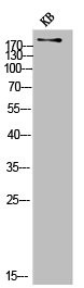 Anti-COL11A1