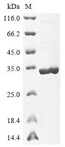 Auxin-responsive protein IAA17 (IAA17), Arabidopsis thaliana, recombinant