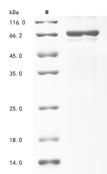 Insulin-like growth factor 2 mRNA-binding protein 1 (IGF2BP1), human, recombinant