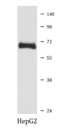 Anti-alpha Fetoprotein