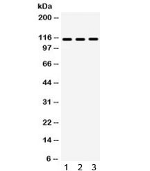 Anti-CD41 / ITGA2B