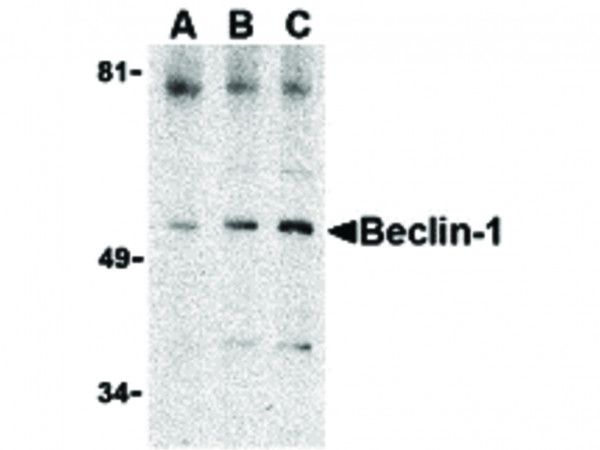 Anti-Beclin-1