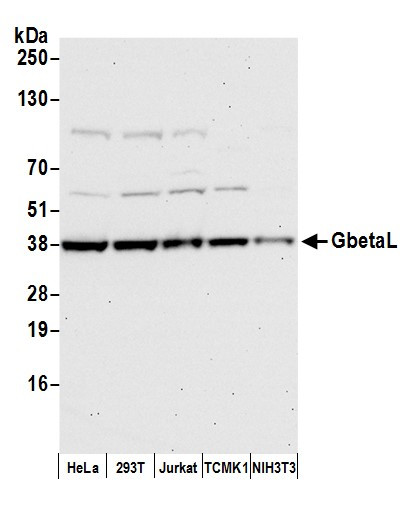 Anti-GbetaL