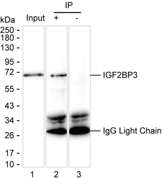 Anti-IGF2BP3