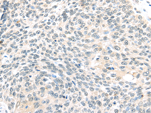 Anti-TCEB1