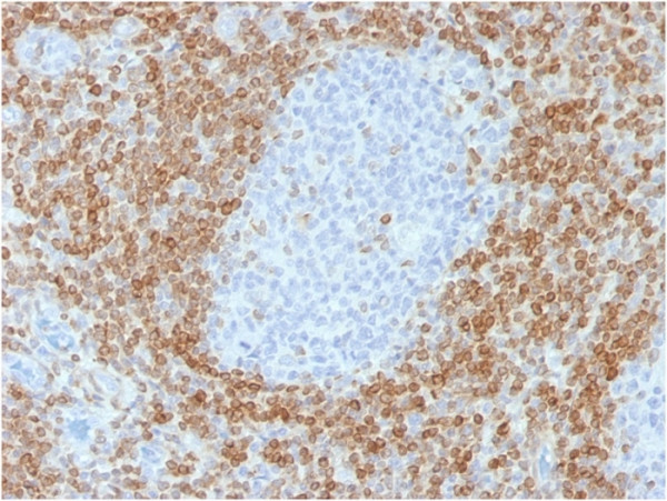 Anti-Bcl-2 (Apoptosis&amp; Follicular Lymphoma Marker), recombinant antibody, clone rBCL2/782