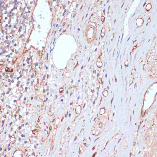 Anti-CD34
