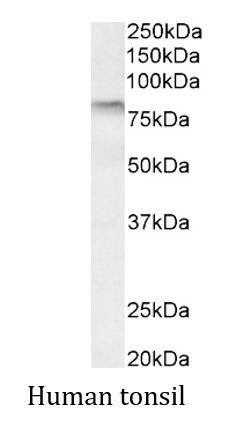 Anti-TGM3 / TGE
