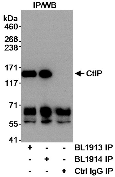 Anti-CtIP