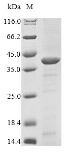 UDP-3-O-acyl-N-acetylglucosamine deacetylase (lpxC), Acinetobacter baumannii, recombinant