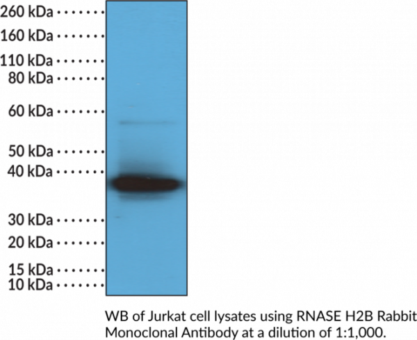 Anti-RNase H2B (C-Term) Rabbit Monoclonal Antibody (Clone RM433)