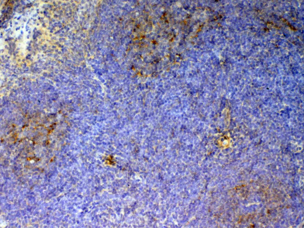 Anti-CD59