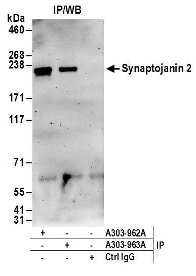 Anti-Synaptojanin 2