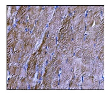 Anti-Dysferlin / DYSF