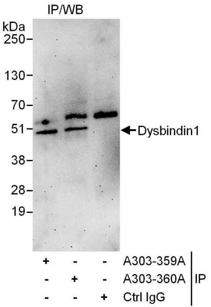 Anti-Dysbindin1