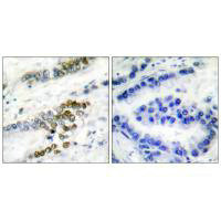 Anti-ERCC1