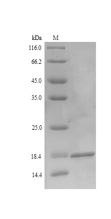 Latent membrane protein 2 (LMP2), partial, Epstein-Barr virus, recombinant