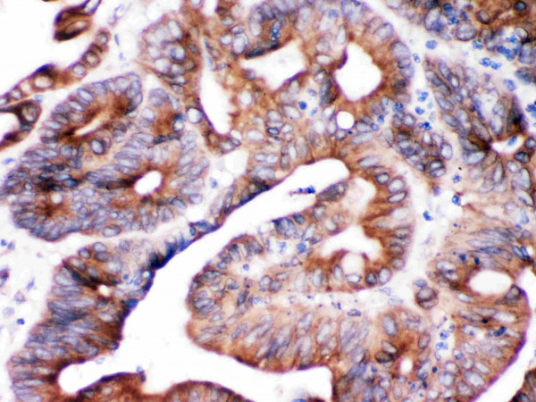 Anti-SPTLC1