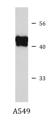 Anti-PAI1 / SERPINE1