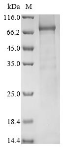 ATP-dependent RNA helicase DDX3Y (DDX3Y), human, recombinant