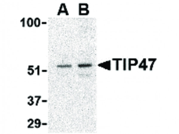 Anti-TIP47