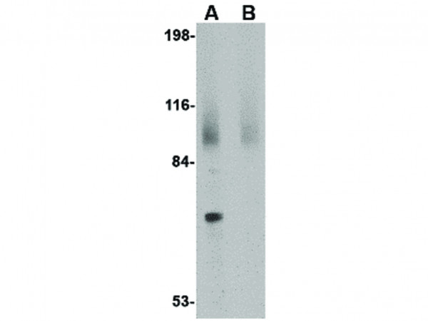Anti-JPH2