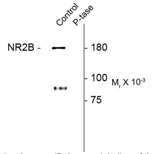 Anti-phospho-NMDAR2B (Tyr1472)