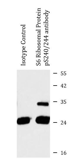 Anti-phospho-S6 Ribosomal Protein (Ser240 / 244)