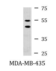 Anti-KMT1A / SUV39H1