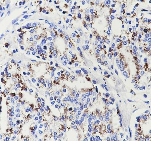 Anti-Recombinant SLC45A3, clone A654