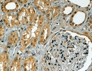 Anti-TRIM5 / RNF88 (alpha isoform), Internal