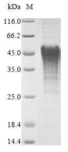 BCL2/adenovirus E1B 19 kDa protein-interacting protein 3 (Bnip3), partial, mouse, recombinant