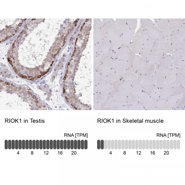 Anti-RIOK1