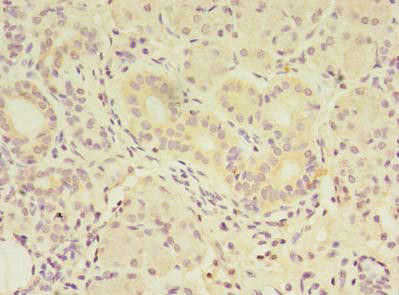 Anti-FAM174A