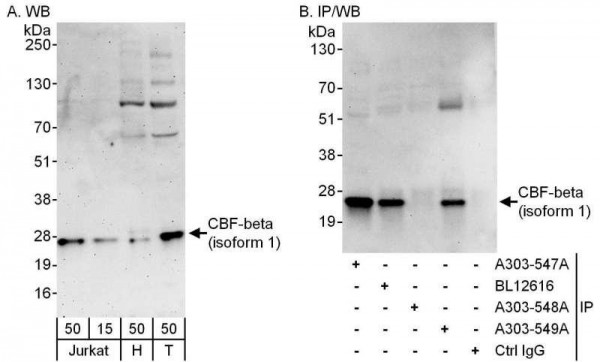 Anti-CBF-beta (isoform 1)