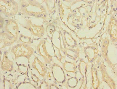 Anti-TTC33
