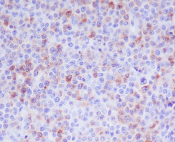 Anti-Granzyme B, clone AAHC-7
