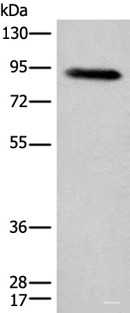 Anti-C1R