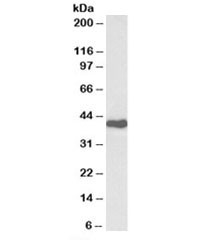 Anti-CDK7