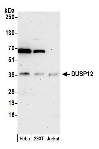 Anti-DUSP12