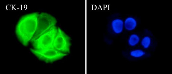 Anti-Cytokeratin 19, clone SQab1872